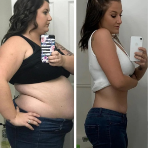 Antes e Depois - 06